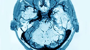 Holpriger Start für die „Apps auf Rezept“