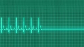 Neues Gerät soll Wiederbelebung nach Herzstillstand verbessern