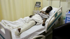 Oppositionsführer bei Versammlung von der Polizei verletzt