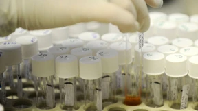 Zellkulturen in der Schwerelosigkeit