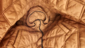 Das ergibt ein Muster