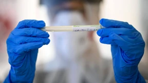 Eine Dreiviertelmilliarde für den Stoff gegen das Virus