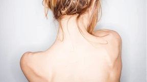 Wie Magersucht das Gehirn angreift