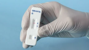 Wie manage ich das Long-Covid-Risiko?