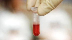 Bluttest für unterwegs