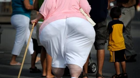 Kasse muss für nötiges Fettabsaugen zahlen