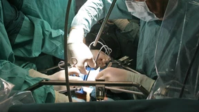 Mensch lebte einen Monat mit Schweineleber