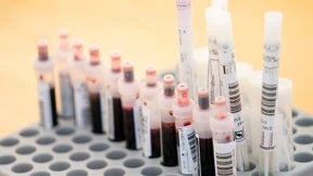 19 neue Coronavirus-Infektionen