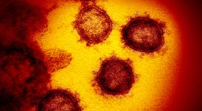 Wie das Coronavirus seine Vermehrung steuert