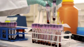 Der Fußball muss bluten