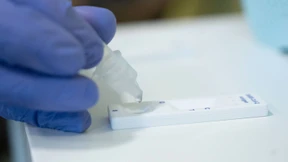 So viele Corona-Todesfälle wie seit zehn Monaten nicht mehr