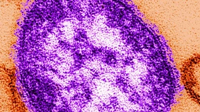 Grippe und Masern treten deutlich seltener auf