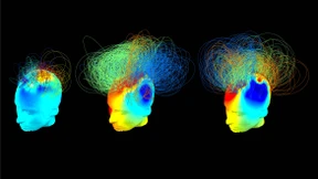 Urteil gegen den Primus der Hirnforschung