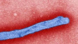 Ebola-Verdachtsfall in Kanada