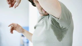 Ab wann ist Schwitzen krankhaft – und wie kann man es behandeln?