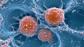 Entwicklungen und Perspektiven der CAR-T-Zell-Therapie