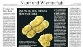 Zweifel an der Mammographie