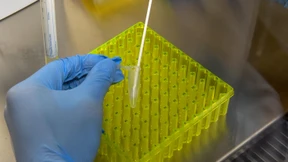 340 registrierte Neuinfektionen in Deutschland