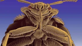 Von wegen französische Bettwanzenplage