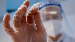 Neuinfektionen gehen im Vergleich zur Vorwoche leicht zurück