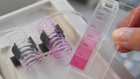 Wie bekommt Deutschland sein Nitrat-Problem in den Griff?