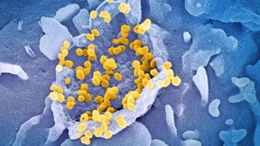 Ist Omikron etwa ein harmloses Virus?