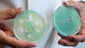 Dutzende Millionen Tote wären bis 2050 vermeidbar