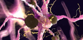 Alzheimer: Eine frühe Diagnose bringt Vorteile