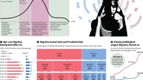Migräne: Die Milliardenkosten einer Volkskrankheit