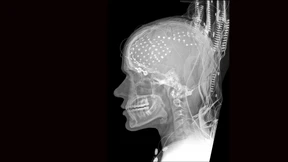 Rückfall in mittelalterliche Forschungsethik