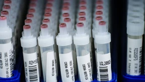 Sieben-Tage-Inzidenz steigt auf 444,3