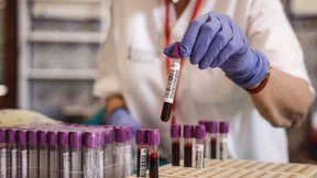 Beschränkungen für Homosexuelle beim Blutspenden sollen entfallen