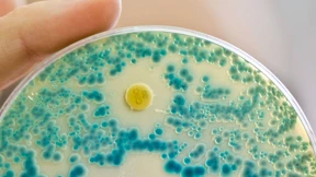 Patientin stirbt nach erfolgloser Behandlung mit 26 Antibiotika