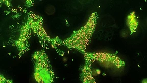 Krankenhauskeim Acinetobacter kann sich tot stellen