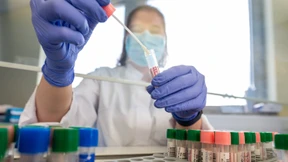 Corona-Inzidenz steigt auf 1426,0