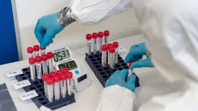 Welche Zweifel angebracht sind