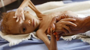 Hungersnot wird immer schlimmer