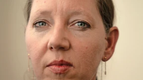 Das wird jetzt kurz wehtun