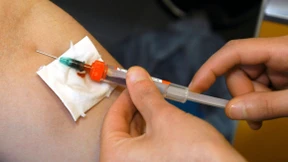 Das Virus hat eine Achillesferse