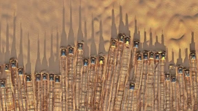 Was tun im globalen Subventionswettlauf?