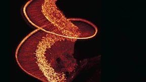 Erleuchtung in der Hörschnecke