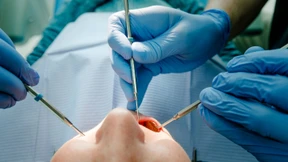 Patientin muss verpfuschte Zahnarzt-Behandlung nicht bezahlen