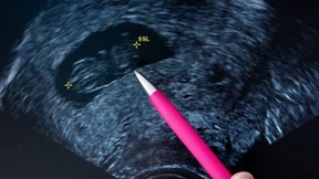 Brandmauer geht vor Reform des Abtreibungsrechts