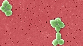 Ein Killerkeim mit Multifunktions-Werkzeug