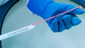 Gynäkologen verwendeten eigenes Sperma zur künstlichen Befruchtung