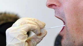 Nur 282 Männer machen bei Gentest mit