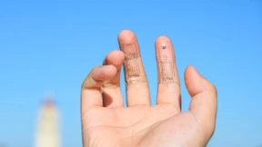 Mehr Feingefühl für Menschen mit Handprothesen