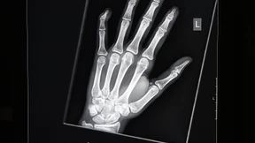 Teenager mit Vollbart und tiefer Stimme