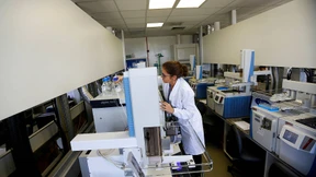 Labor-Suspendierung in Rio soll keine negativen Folgen haben