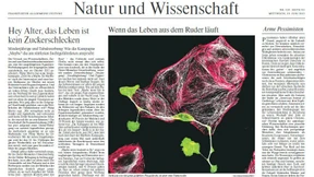 Zweifel an britischer  Brustkrebstudie 